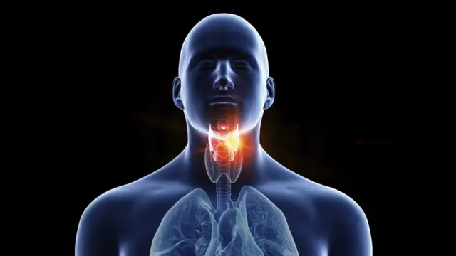 Throat Cancer