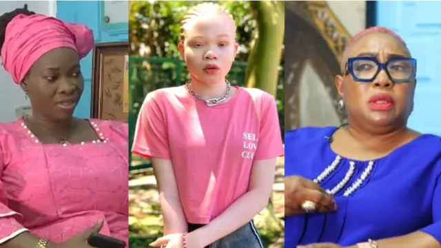 Se looto Aafin Albino