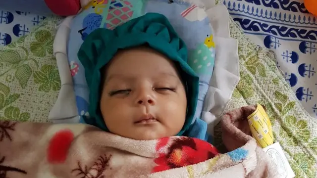 அறுவை சிகிச்சைக்குப் பின் குழந்தை நலமுடன் உள்ளது.