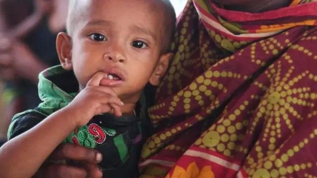 박테리아와 영양실조에 관한 연구의 시초는 남아공 출신 의사 PM 심떼의 1958년 렌셋 논문에서 찾을 수 있다