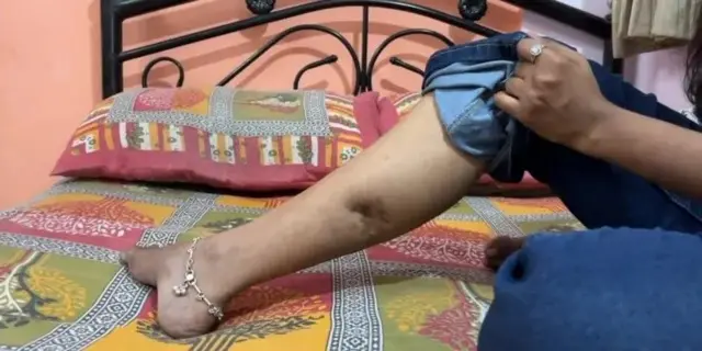 ان کی ٹانگ پر ابھی بھی گولی کے زخم کے نشان باقی ہیں