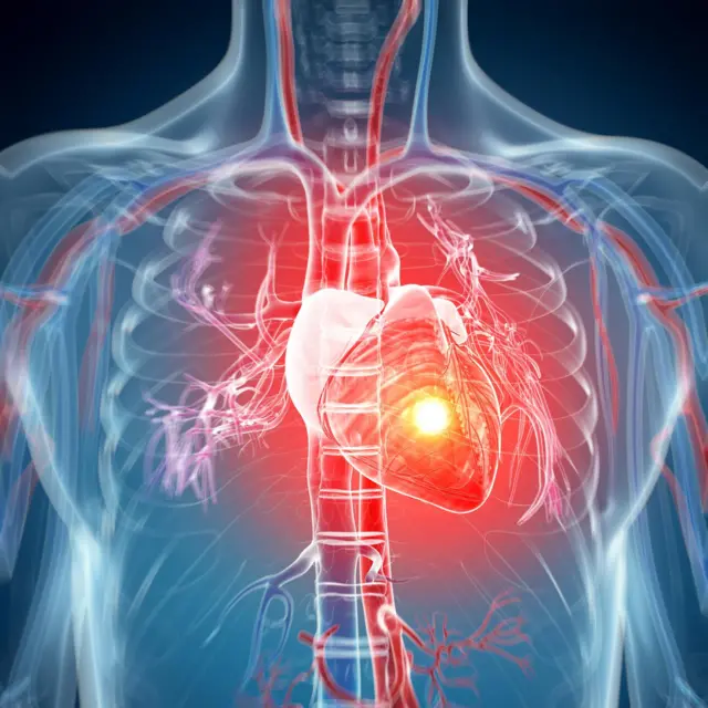 ਕਾਰਡੀਐਕ ਅਰੈਸਟ