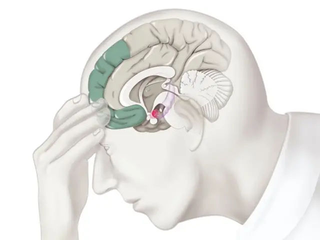 Diagrama del cerebro