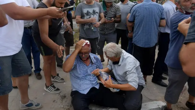 جريح في الاشتباكات.