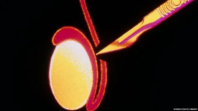 प्रातिनिधिक फोटो