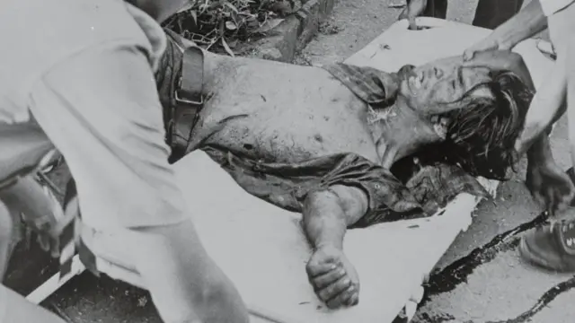 Estudiante herido durante la masacre