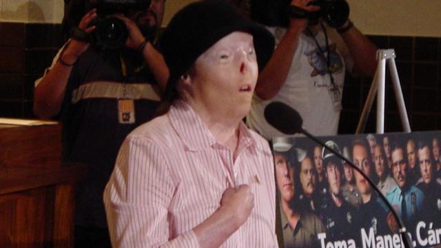 Jacqui Saburidoblaze jogo fogueteentrevista à imprensa