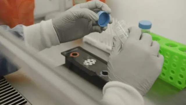 KORONAVIRUS