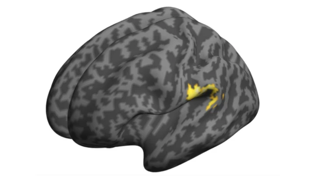 القشرة السمعية في الدماغ (باللون الأصفر)