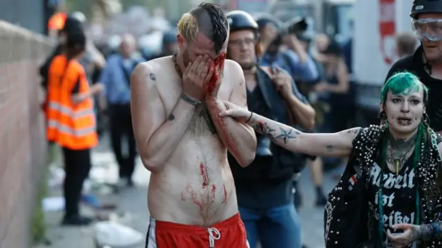 Manifestante ensangrentado en Hamburgo.