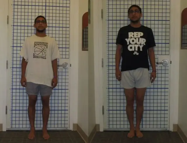 सॅम, पायावर शस्त्रक्रिया, विज्ञान