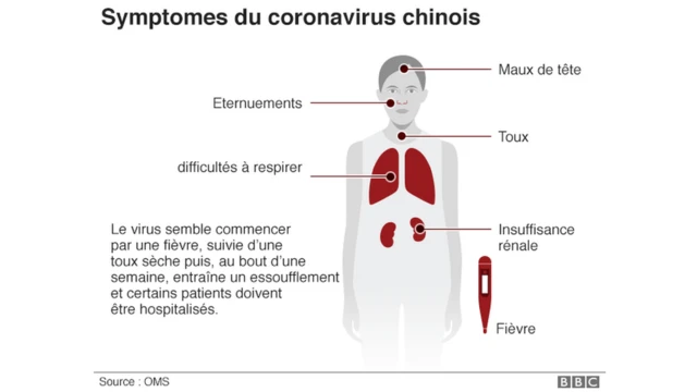 Voici les symptômes du coronavirus