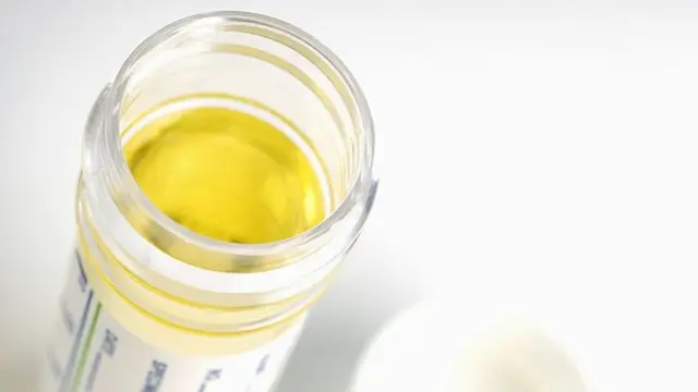 پیشاب، امریہ