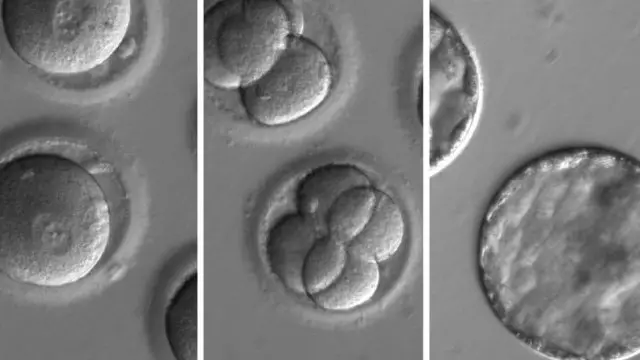 ترمیم دی ان ای در جنین انسان