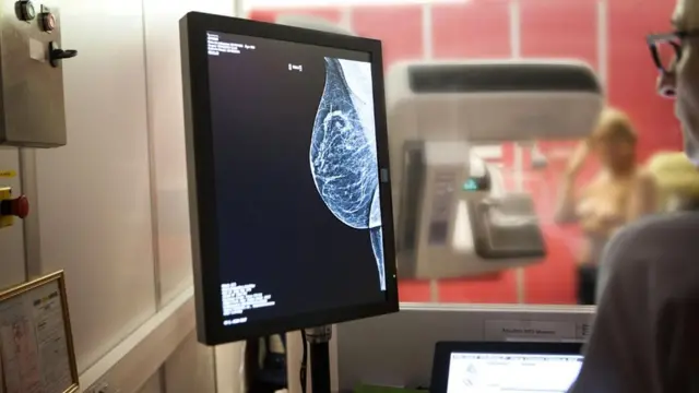 باتت الطفرات التي تصيب جينيْ BRCA1 وBRCA2 ترتبط في الأذهان بإصابة النساء بسرطان الثدي، رغم معاناة الرجال منها أيضا