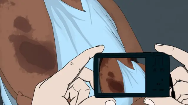 شخص يصور الكدمات