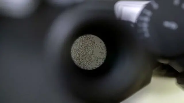 టి కణాలు