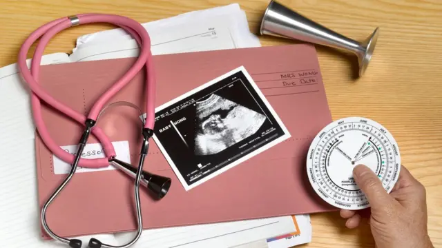 Imagen de sonograma