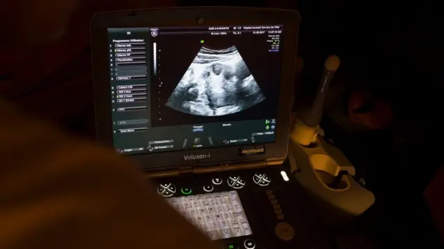 한국 여성들의 산부인과에 대한 인식은 전반적으로 부정적인 것으로 나타났다