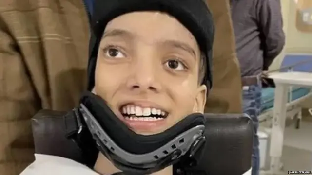 அஃப்ஷீன்