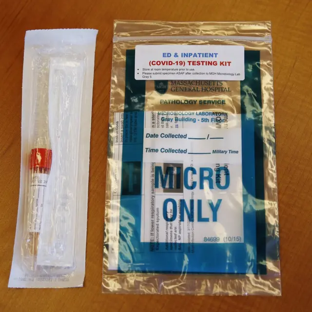 Koronavirüs test kiti