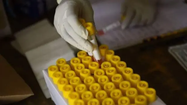 ગુજરાતમાં ફરી એક વખત કોરોના વાઇરસના કેસમાં વધારો