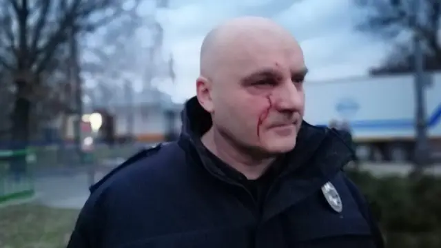 Внаслідок сутички у Черкаса постраждали 15 правоохоронців, повідомляє поліція