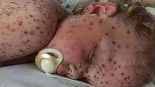 Mmoja wa watoto waliyodai wanaugua saratani