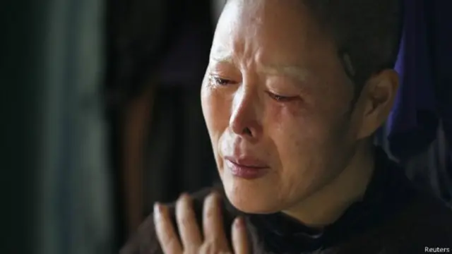 Kilio cha uchungu baada ya upasuaji wa pua ili kunyooshwa