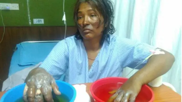 සුනීතා හස්රා