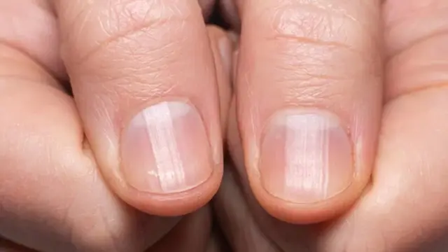 நகங்கள்