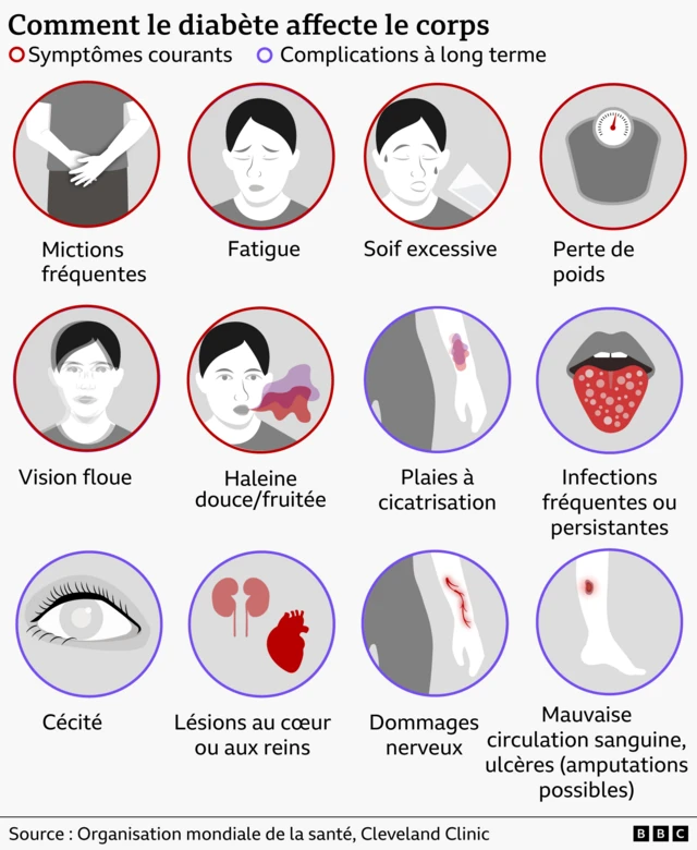 Un graphique illustrant les effets du diabète sur l'organisme. Les symptômes courants incluent des mictions fréquentes, de la fatigue, une soif excessive, une perte de poids, une vision trouble et une haleine douce/fruitée. Les symptômes à long terme comprennent des plaies qui guérissent lentement, des infections fréquentes ou durables, la cécité, des lésions cardiaques ou rénales, des lésions nerveuses et une mauvaise circulation sanguine.