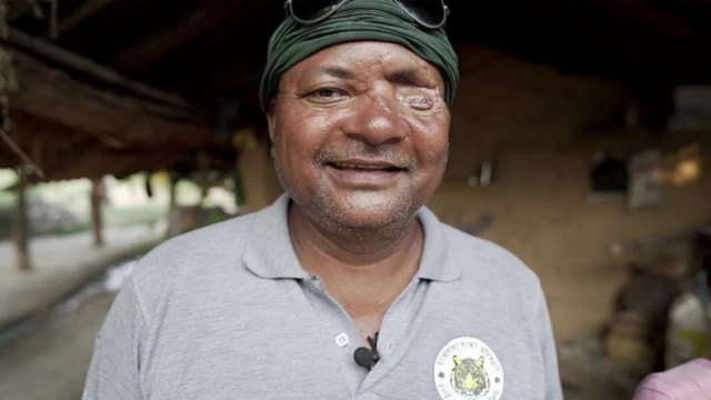 Bhadai Tharu, seorang konservasionis, kehilangan sebelah matanya karena serangan harimau.