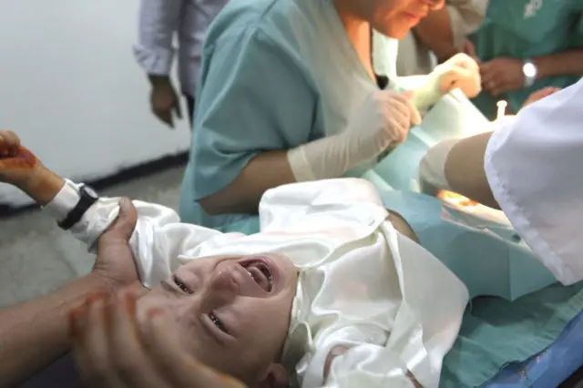 ختنے ، فائل فوٹو