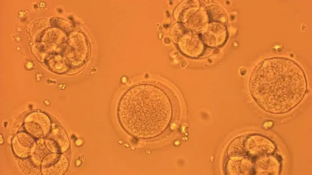 የላብራቶሪ ምስል 