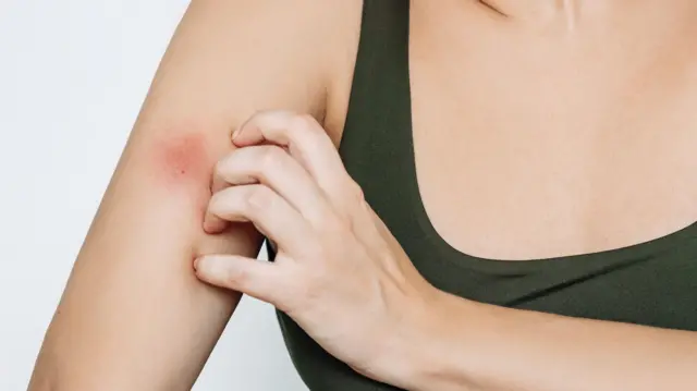 கேன்டிடியாசிஸ், பிறப்புறுப்பு அரிப்பு, மருத்துவம், நோய்த்தொற்று