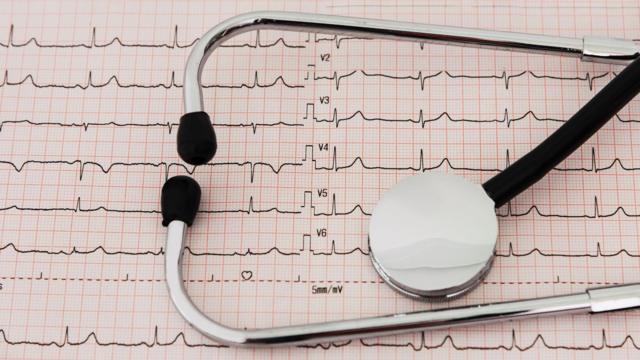 Estetoscópio e gráficoslot play n gocardiologia (fotoslot play n goarquivo)