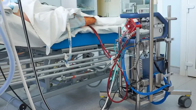 Extracorporeal membrane oxygenation