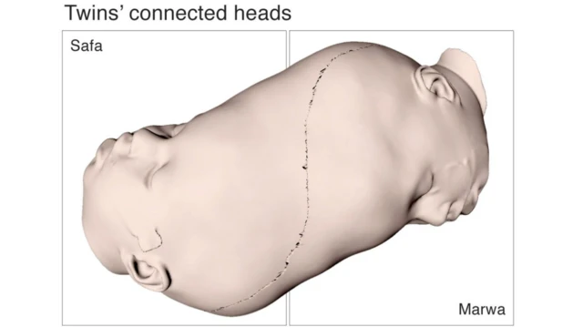 እቲ ቀዳማይ ዕማም ሰለስተ ዓበይቲ ኽፋላት ሽክና ርእሲ ምልጋስ እዩ