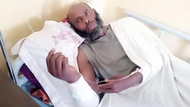 Maanguddoo haleellaa Jimaataatiin rasaasaan miidhaan harkarra gahee hospitaala Adaamaatti yaalarra jira