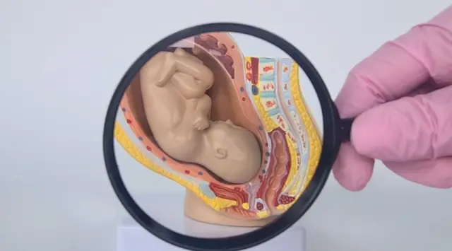 If the placenta is not functioning properly and the baby is not receiving an adequate supply of oxygen and nutrients, this is also considered a medical emergency.