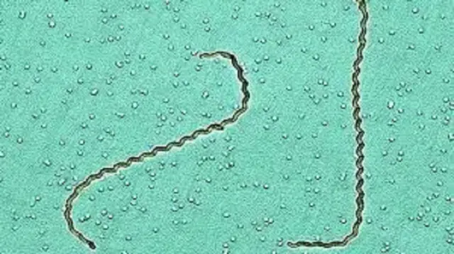 Leptospiroza je zoonoza uzrokovana spiralnim bakterijama iz roda Leptospira, koje obitavaju u bubrezima svojih prirodnih domaćina