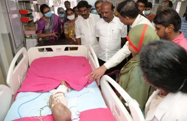 குழந்தைக்கு வலது கை அகற்றம் ஏன்?