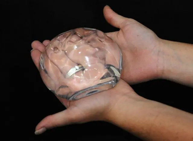 بریسٹ امپلانٹس