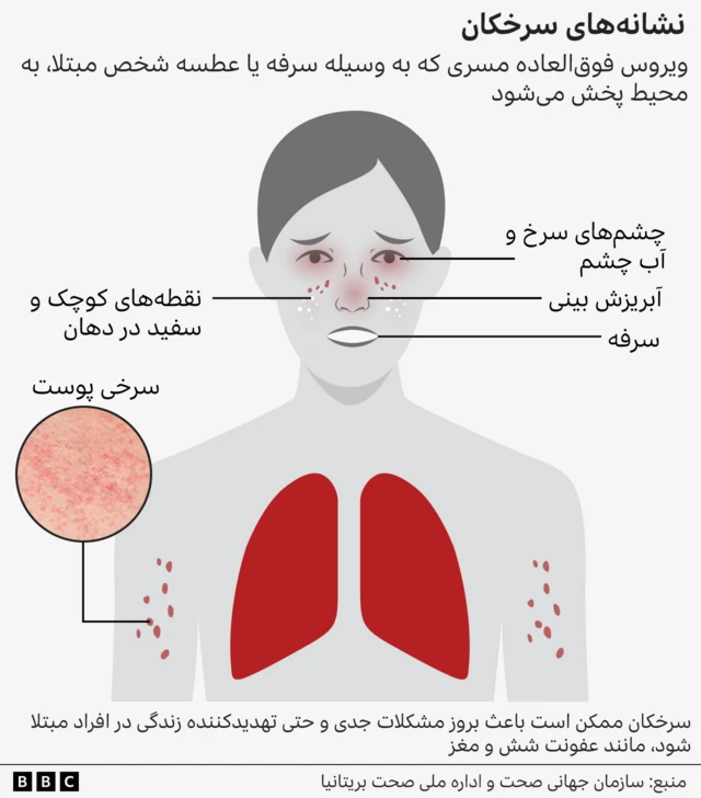 گرافیکی که علائم سرخکان را توضیح می‌دهد