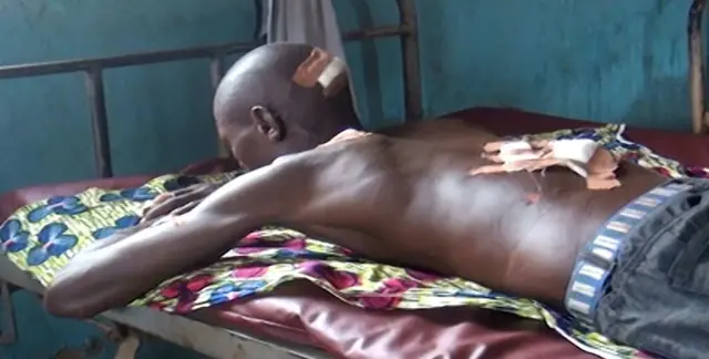 One of di victims of di suspected herders attack, na man wey lie down for bed wey no wear cloth to show im injury.