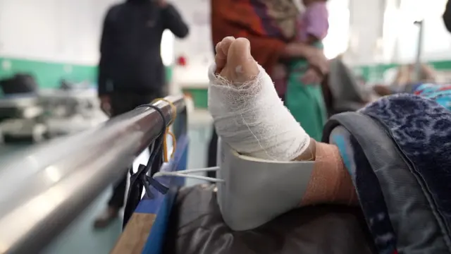 भुकम्पमा परेर घाइतेको खुट्टा।