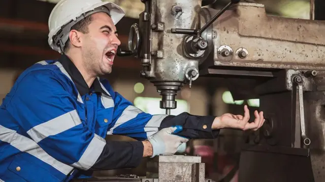 Foto ilustrasi. Seorang pekerja mengalami cedera lengan akibat mesin tua yang tidak aman di tempat kerja industri.