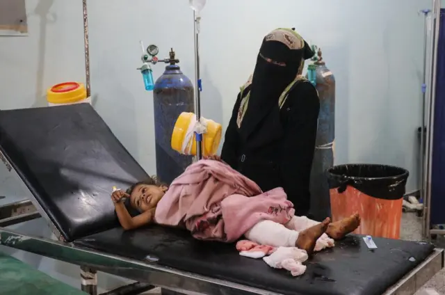 امرأة تقف إلى جانب طفل مصاب يتلقى العلاج في مستشفى، عقب ضربة بطائرة مسيّرة نُسبت إلى الحوثيين في منطقة المشع بحيس، جنوبي الحديدة.
