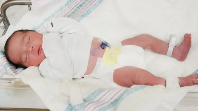 தொப்புள் கொடி ரத்தம் சேகரிப்பு